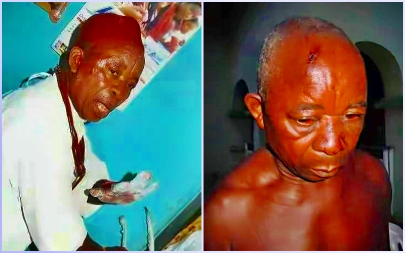 L-R: Victims of Suspected Fulani Attacks in Ubulu-Uku Community of Delta State, Late Chief Chikwe Ojinji and Injured Victim