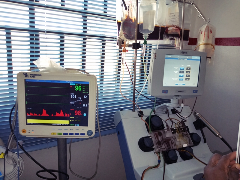 Automated Exchange Blood Transfusion Using the Spectra Optia Apheresis System at the Delta State Sickle Cell Centre