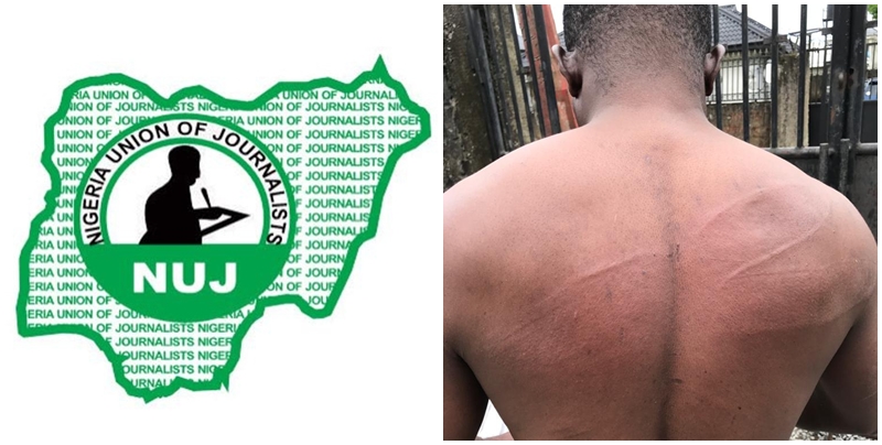 Pics Inset: Injury on Delta Journalist, Comrade Akpokona Omafuaire as a result of Assault by Policemen