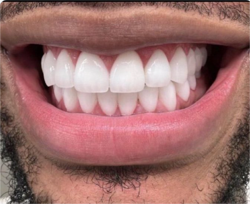 Brush your Teeth