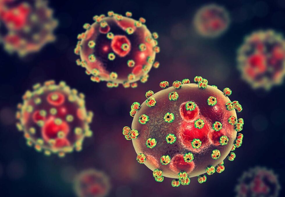 Lassa Fever