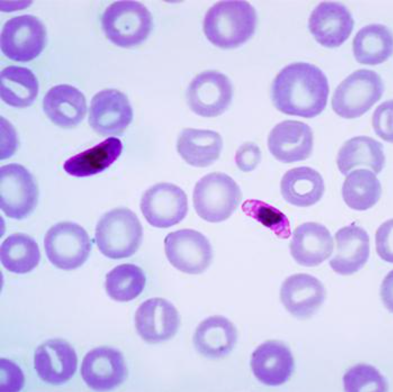 Plasmodium falciparum